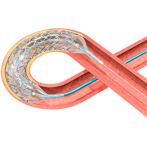 BioMatrix Alpha Drug-Eluting Stent System